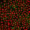 CD20 antibody, AE00205, Aeonian Biotech, Immunocytochemistry image 