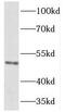Homeobox C10 antibody, FNab03979, FineTest, Western Blot image 
