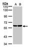 Protein TBRG4 antibody, TA308131, Origene, Western Blot image 