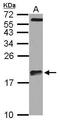 Actin Related Protein 2/3 Complex Subunit 5 Like antibody, GTX120725, GeneTex, Western Blot image 