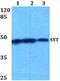 SS18 Subunit Of BAF Chromatin Remodeling Complex antibody, PA5-36199, Invitrogen Antibodies, Western Blot image 