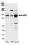 Double-stranded RNA-specific adenosine deaminase antibody, A303-883A, Bethyl Labs, Western Blot image 
