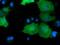 DnaJ Heat Shock Protein Family (Hsp40) Member A2 antibody, MA5-25232, Invitrogen Antibodies, Immunocytochemistry image 