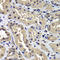 Cell Cycle And Apoptosis Regulator 2 antibody, LS-C346240, Lifespan Biosciences, Immunohistochemistry paraffin image 