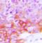 EGFR antibody, orb393269, Biorbyt, Immunohistochemistry paraffin image 