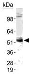 Zinc Metallopeptidase STE24 antibody, GTX48521, GeneTex, Western Blot image 