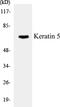 Keratin 5 antibody, EKC1327, Boster Biological Technology, Western Blot image 