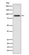 Ribosomal Protein S6 Kinase A6 antibody, M07352, Boster Biological Technology, Western Blot image 