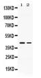 Abhydrolase Domain Containing 5 antibody, PA5-78704, Invitrogen Antibodies, Western Blot image 