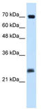 SERTA domain-containing protein 1 antibody, TA335639, Origene, Western Blot image 