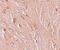 Zinc Finger And BTB Domain Containing 3 antibody, 6119, ProSci, Immunohistochemistry paraffin image 