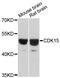 Cyclin Dependent Kinase 15 antibody, LS-C748227, Lifespan Biosciences, Western Blot image 