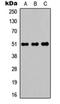 POTE ankyrin domain family member A antibody, orb304514, Biorbyt, Western Blot image 