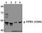 Tryptophan Hydroxylase 1 antibody, A01626S260, Boster Biological Technology, Western Blot image 