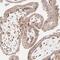 SPARC antibody, HPA002989, Atlas Antibodies, Immunohistochemistry frozen image 