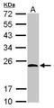 BTB/POZ domain-containing protein KCTD15 antibody, GTX116797, GeneTex, Western Blot image 