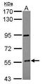 Cytochrome P450 Family 4 Subfamily F Member 12 antibody, PA5-28163, Invitrogen Antibodies, Western Blot image 