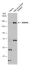 Lysine Demethylase 4A antibody, GTX128497, GeneTex, Western Blot image 