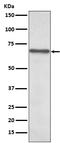 p65 antibody, M00284, Boster Biological Technology, Western Blot image 