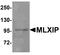 MLX Interacting Protein antibody, A08709, Boster Biological Technology, Western Blot image 