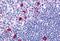 Cannabinoid Receptor 2 antibody, MBS244213, MyBioSource, Immunohistochemistry paraffin image 