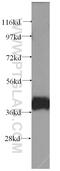 HAUS Augmin Like Complex Subunit 1 antibody, 11094-2-AP, Proteintech Group, Western Blot image 