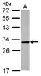 CAC antibody, GTX105562, GeneTex, Western Blot image 