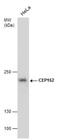 Centrosomal Protein 152 antibody, NBP2-43722, Novus Biologicals, Western Blot image 