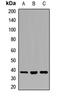 RNA Binding Motif Protein 22 antibody, orb411643, Biorbyt, Western Blot image 