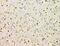 PTPN11 antibody, M00150-2, Boster Biological Technology, Immunohistochemistry paraffin image 