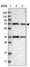 ENTH Domain Containing 1 antibody, NBP1-93911, Novus Biologicals, Western Blot image 