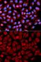 Mitogen-Activated Protein Kinase 9 antibody, GTX32689, GeneTex, Immunocytochemistry image 