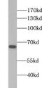 Zinc Finger Protein 512 antibody, FNab09711, FineTest, Western Blot image 