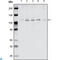 EPHB1 antibody, LS-C812457, Lifespan Biosciences, Immunohistochemistry paraffin image 