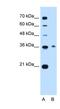 Chromosome 11 Open Reading Frame 54 antibody, NBP1-56904, Novus Biologicals, Western Blot image 