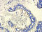 KLK3 antibody, orb13526, Biorbyt, Immunohistochemistry paraffin image 