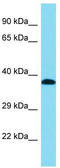 Dehydrogenase/Reductase 13 antibody, TA335396, Origene, Western Blot image 