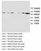 Glutamate Ionotropic Receptor NMDA Type Subunit 1 antibody, LS-C172008, Lifespan Biosciences, Western Blot image 