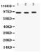 FER Tyrosine Kinase antibody, PA5-79248, Invitrogen Antibodies, Western Blot image 