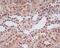 Hypoxia-inducible factor 1-alpha antibody, M00013-3, Boster Biological Technology, Immunohistochemistry paraffin image 