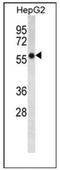 Fatty acid desaturase 2 antibody, AP51507PU-N, Origene, Western Blot image 