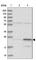 Ribosomal Protein L13a antibody, HPA038751, Atlas Antibodies, Western Blot image 