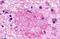 GP160 antibody, NLS542, Novus Biologicals, Immunohistochemistry paraffin image 