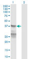 Calponin 3 antibody, LS-C139409, Lifespan Biosciences, Western Blot image 