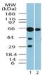 Atypical Chemokine Receptor 3 antibody, ab72100, Abcam, Western Blot image 
