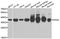 Pyridoxal kinase antibody, A06683, Boster Biological Technology, Western Blot image 