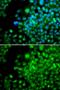 Four And A Half LIM Domains 1 antibody, GTX33199, GeneTex, Immunocytochemistry image 