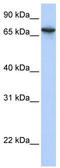 Abhydrolase Domain Containing 16A antibody, TA338460, Origene, Western Blot image 