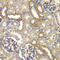 RAB5C, Member RAS Oncogene Family antibody, LS-C349068, Lifespan Biosciences, Immunohistochemistry paraffin image 