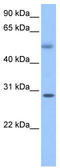 Elongator Acetyltransferase Complex Subunit 5 antibody, TA335331, Origene, Western Blot image 